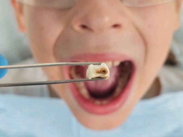 Best Emergency Cosmetic Dentistry in Riviera Beach, MD